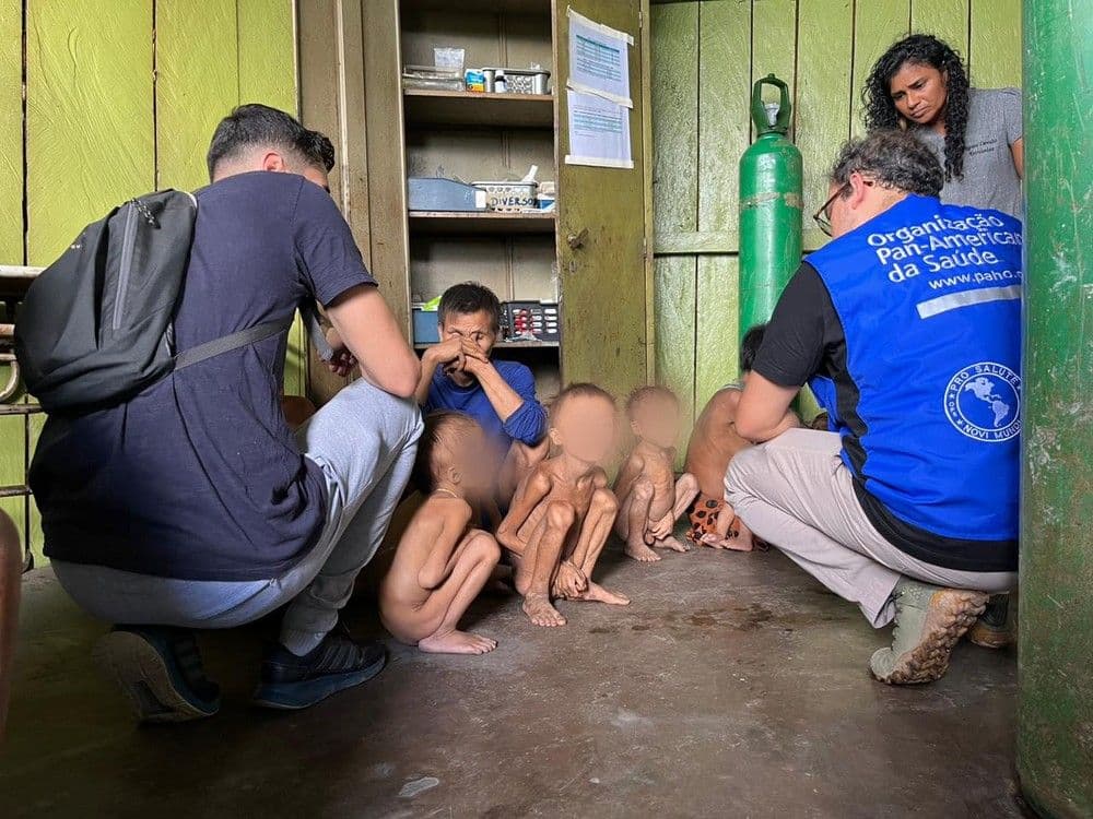 Crianças Yanomami com desnutrição severa_Foto_Condisi-YY_Divulgação.jpg